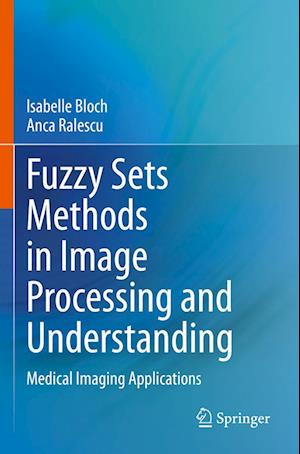 Fuzzy Sets Methods in Image Processing and Understanding