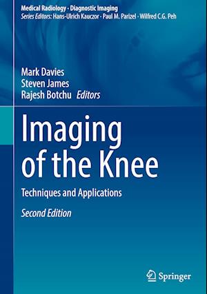 Imaging of the Knee