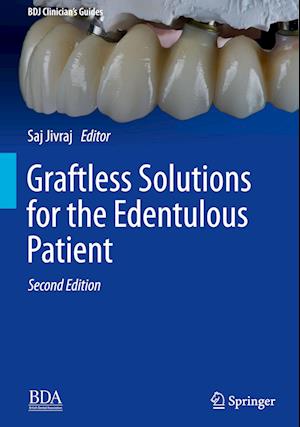 Graftless Solutions for the Edentulous Patient