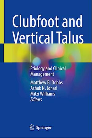 Clubfoot and Vertical Talus