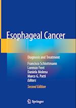 Esophageal Cancer