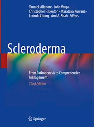 Scleroderma