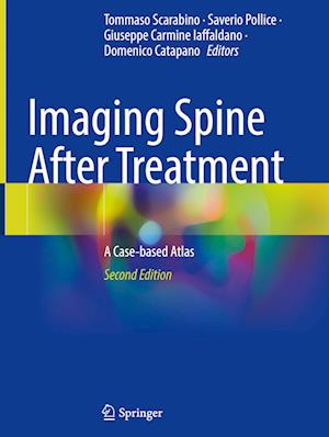 Imaging Spine After Treatment