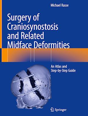 Surgery of Craniosynostosis and Related Midface Deformities