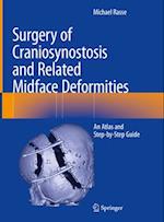 Surgery of Craniosynostosis and Related Midface Deformities