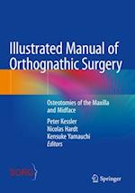 Illustrated Manual of Orthognathic Surgery