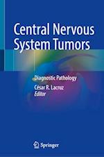 Central Nervous System Tumors