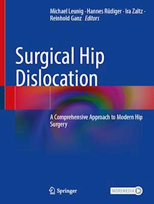 Surgical Hip Dislocation