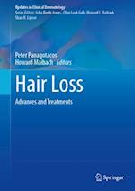 Hair Loss