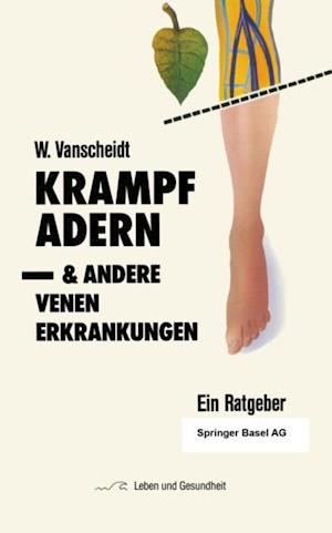 Krampfadern und andere Venenerkrankungen