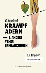 Krampfadern und andere Venenerkrankungen