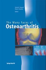 Many Faces of Osteoarthritis