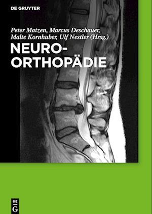 Neuroorthopädie