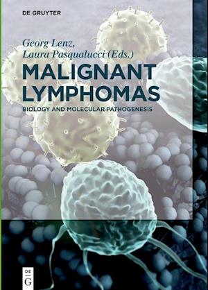 Malignant Lymphomas