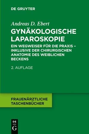 Gynäkologische Laparoskopie