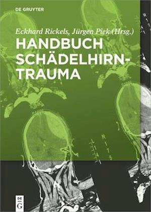 Handbuch Schädelhirntrauma