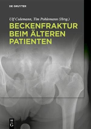 Beckenfraktur beim älteren Patienten