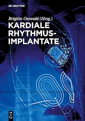 Kardiale Rhythmusimplantate