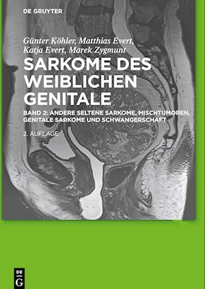 Sarkome des weiblichen Genitale 2