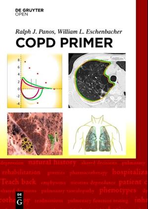 COPD Primer