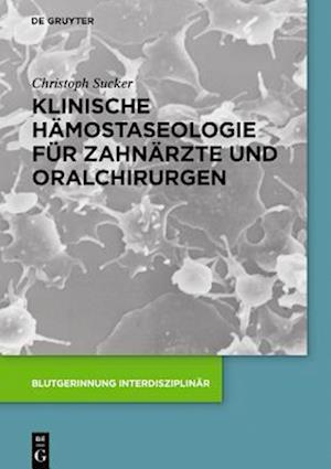 Klinische Hämostaseologie für Zahnärzte und Oralchirurgen