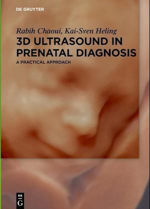 Chaoui, R: 3D Ultrasound in Prenatal Diagnosis