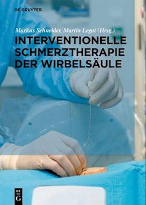 Interventionelle Schmerztherapie der Wirbelsäule