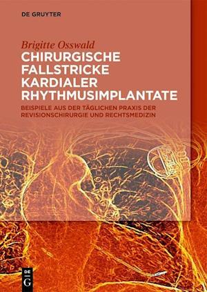 Chirurgische Fallstricke kardialer Rhythmusimplantate