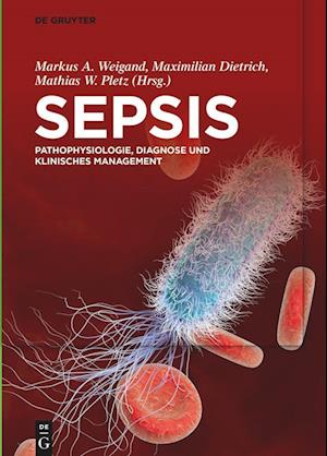 Sepsis