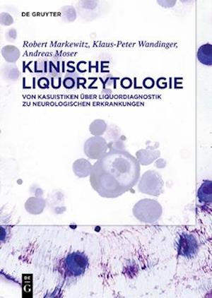 Klinische Liquorzytologie