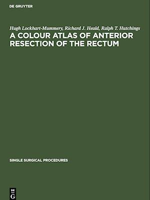 A Colour Atlas of Anterior Resection of the Rectum