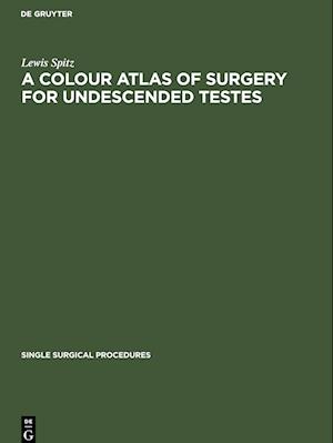 A Colour Atlas of Surgery for Undescended Testes