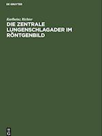 Die zentrale Lungenschlagader im Röntgenbild