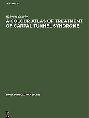 A Colour Atlas of Treatment of Carpal Tunnel Syndrome