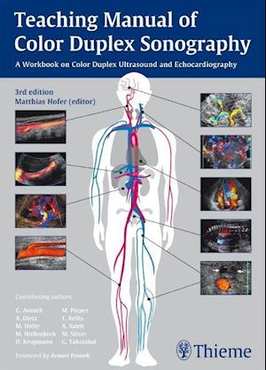 Teaching Manual of Color Duplex Sonography