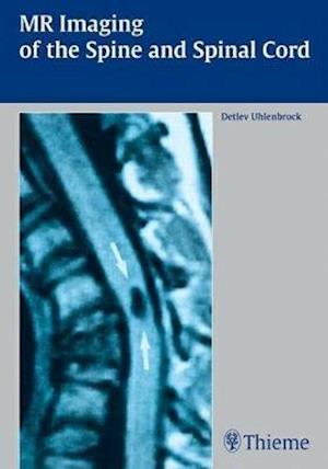MR Imaging of the Spine and Spinal Cord