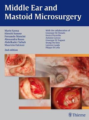 Middle Ear and Mastoid Microsurgery