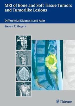 MRI of Bone and Soft Tissue Tumors and Tumorlike Lesions : Differential Diagnosis and Atlas