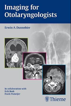 Imaging for Otolaryngologists