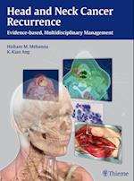 Head and Neck Cancer Recurrence : Evidence-based, Multidisciplinary Management