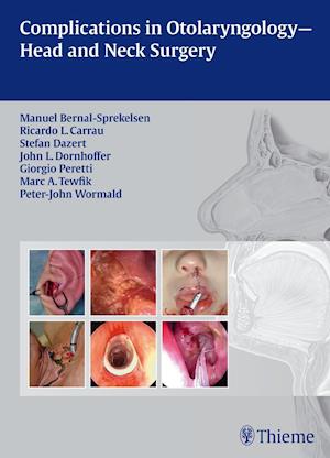 Complications in Otolaryngology - Head and Neck Surgery