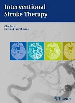 Interventional Stroke Therapy