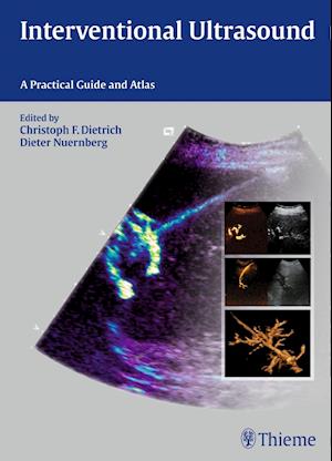 Interventional Ultrasound : A Practical Guide and Atlas