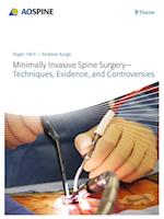 Minimally Invasive Spine Surgery - Techniques, Evidence, and Controversies