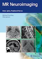 MR Neuroimaging: Brain, Spine, and Peripheral Nerves