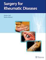 Surgery for Rheumatic Diseases