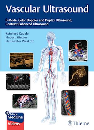 Vascular Ultrasound