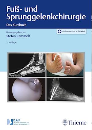 Fuß- und Sprunggelenkchirurgie