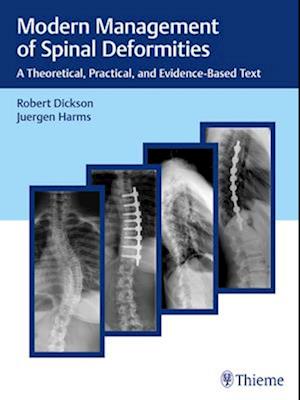 Modern Management of Spinal Deformities: A Theoretical, Practical, and Evidence-Based Text