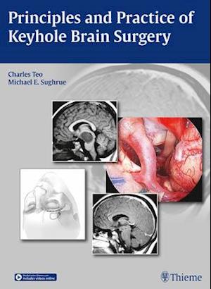 Principles and Practice of Keyhole Brain Surgery